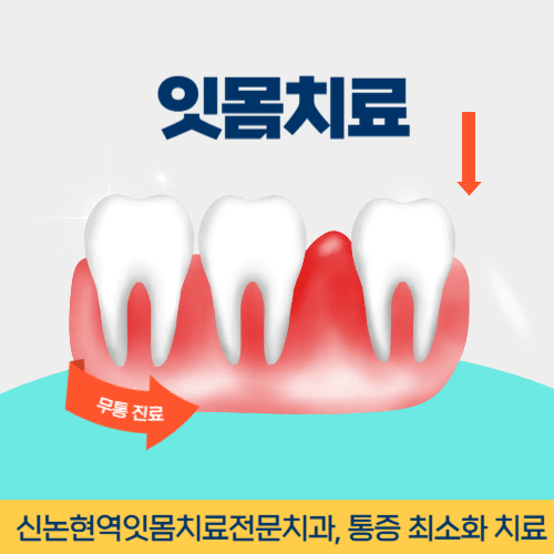 영천치과 영천시 치과 잇몸치료